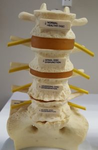 Spinal Column Display in Seaford DE